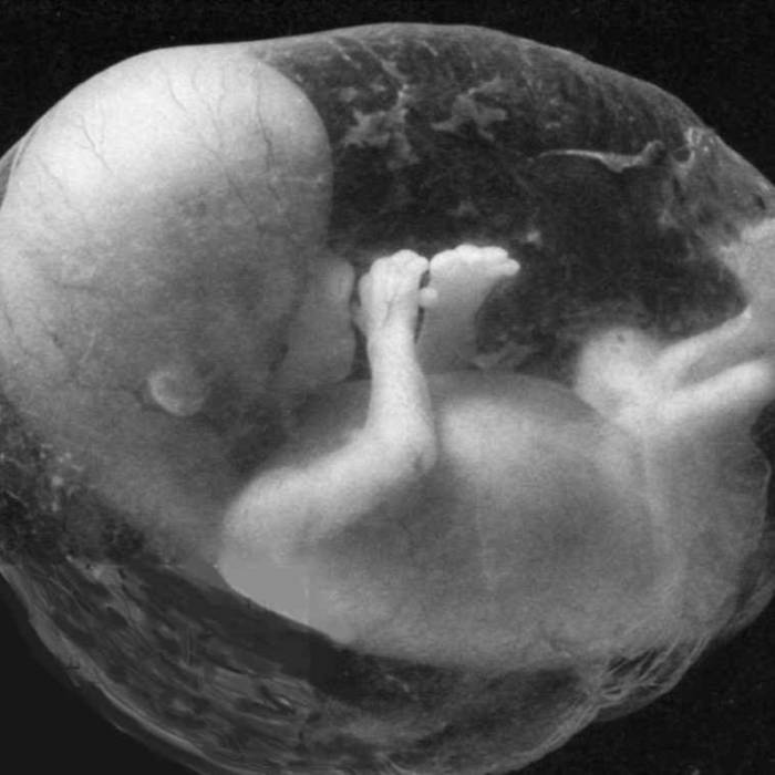 Spilled Into This Disgrace Of World